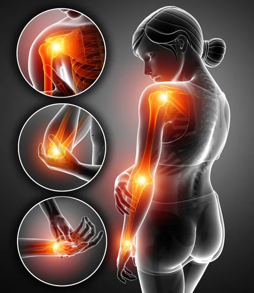 3D illustration av kvinnlig känsla Arm ledvärk — Stockfoto