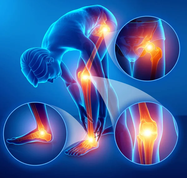 3D ilustracja mężczyzna uczucie ból nóg — Zdjęcie stockowe