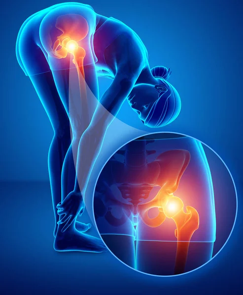 3d ілюстрація жінки з болем в стегні — стокове фото