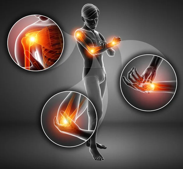 3d Illustration of Men Feeling Arm joint pain — Stock Photo, Image