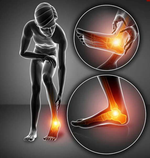 3d illustration of male foot with ankle pain