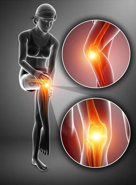3d Illustration of Female feeling Knee pain — Stock Photo, Image