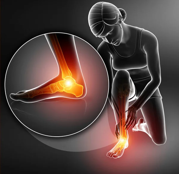 Erkek 3D çizimi ayak ayak bileği ağrısı ile — Stok fotoğraf