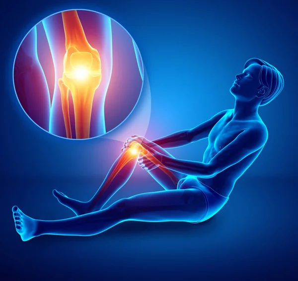 3d Illustration of Male feeling Knee pain — Stock Photo, Image