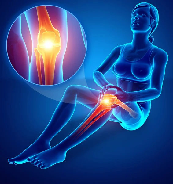 stock image 3d Illustration of Female feeling Knee pain