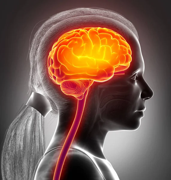 Boyutlu Tıbben Doğru Beyin Baş Ağrısı Vurgulanmış Genç Bir Kızın — Stok fotoğraf