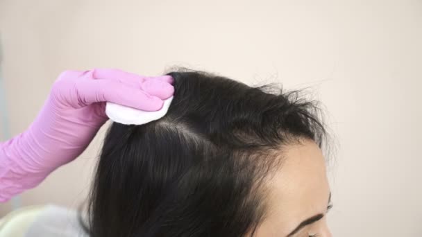 ニードル メソセラピー 化粧品されて女性の頭の中に注入します 髪の成長を強化する推力 — ストック動画