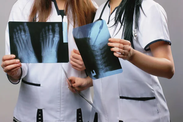 Dos mujeres médicas que miran rayos X en un hospital. Médico radiólogo —  Fotos de Stock