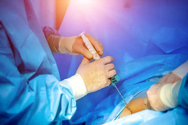 Stem cells operation. Health care concept. Surgeons team working. Bone marrow transplant operation. Plasma in syringe. — Stock Photo, Image