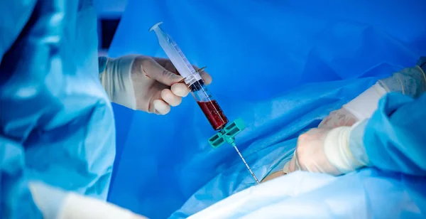 Platelet-Rich plasma preparation. Plasma in syringe. Modern equipment in operating room. — Stock Photo, Image