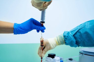 Kök hücre terapisi. Şırıngada plazma. Santrifüj.