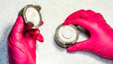 Oftalmolog elinde göz protezi için bir kutu tutuyor. Birlikte