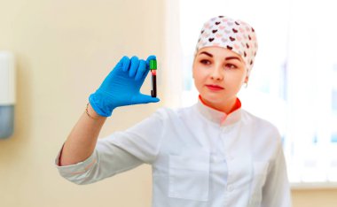 Scrabs 'taki doktor, kliniğin arka planında kırmızı kan tutuyor. Sağlık teşhisi konsepti. Model laboratuarı. Kapat.
