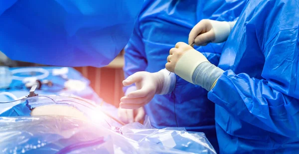 手术室正在进行手术 在明亮的现代化手术室进行外科手术的医疗队 — 图库照片