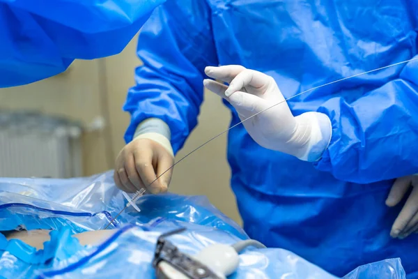 제복을 의사들이 수술을 신경외과 의사들의 클로즈업 — 스톡 사진