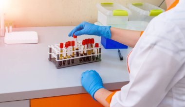 Tepside kan olan test tüpleri. Kan laboratuarı. Hastalık testi. Acil durum testi. Virüs enfeksiyonu. Zatürree testi. COVID-19 ve koronavirüs teşhisi. Pandemia.