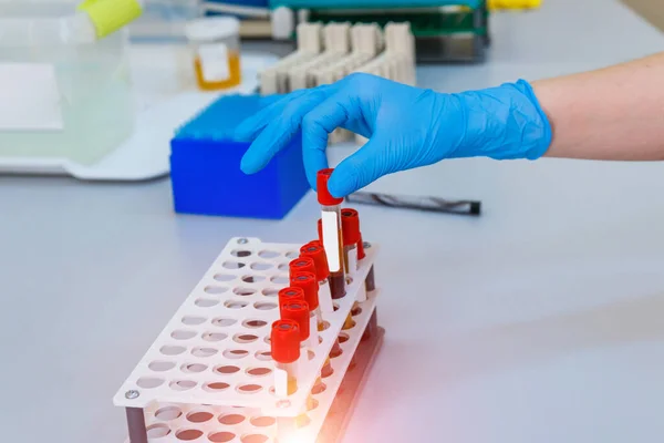 Nurse Arranges Test Tubes Blood Tray Virus Infection Pneumonia Testing — Stock Photo, Image