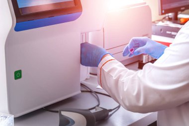 Laboratuvarda kan analizi yapan bir bilim adamı. Coronavirus 2019-nCoV Kan Numunesi