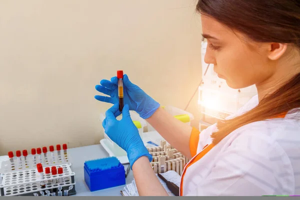 Laboratuvarda Kan Örneğiyle Çalışan Bir Bilim Adamı Coronavirus 2019 Ncov — Stok fotoğraf