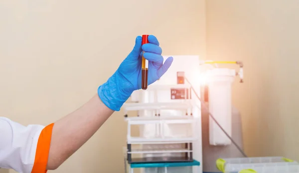 Eldivenli Laboratuvar Asistanının Elleri Kan Örneğini Analiz Ediyor Önlem Olarak — Stok fotoğraf