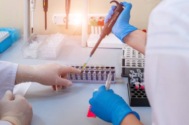 Laboratuvarda kimyasal elementleri inceleyen ciddi bir klinisyen. Hematoloji laboratuvarı. Zatürree teşhisi. COVID-19 ve koronavirüs teşhisi. Salgın. Kanlı ilaç damlası..