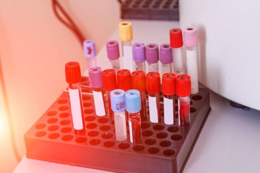 Tepside kan olan test tüpleri. Kan laboratuarı. Hastalık testi. Acil durum testi. Virüs enfeksiyonu. Zatürree testi. COVID-19 ve koronavirüs teşhisi. Salgın.