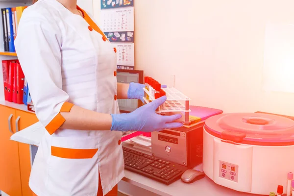 Kan Tüpleri Analizi Için Hematoloji Laboratuarında Test Edilecek Zatürree Teşhisi — Stok fotoğraf