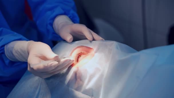 Pacjent Pod Sterylną Osłoną Zbliżenie Szczegółów Operacji Oka — Wideo stockowe