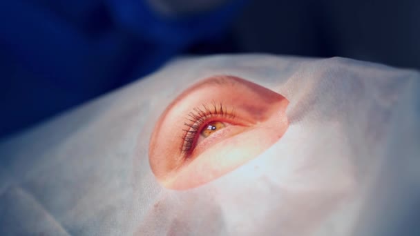 患者の眼の治療 現代の診療所で眼科手術を行う医師 — ストック動画