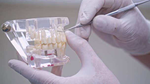 歯医者は歯の模型を持ってる 歯医者は棒を握って歯のモデルを指差す — ストック動画