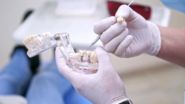 Médico Segurando Modelo Mandíbula Dentes Modelo Dentes Segurando Pelo Médico — Vídeo de Stock