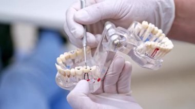 Diş tedavisi ve tedavisi. Doktorun plastik diş modelini elinde tuttuğu yakın plan.
