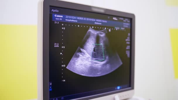 Usg Medyczne Ultrasonograf Nowoczesnym Laboratorium Operacyjnym — Wideo stockowe
