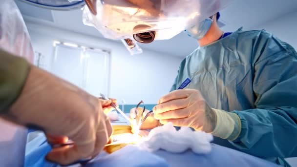 外科团队操作病人 医院进行微创手术的外科医生医疗队 — 图库视频影像