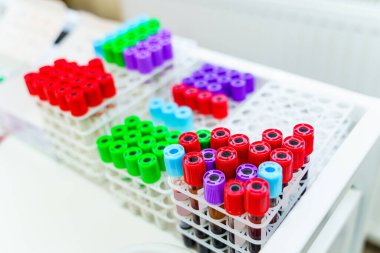 Mikro küp araştırmaları için kan örnekleri. Laboratuvarda test ediliyor. Kimyasal araştırma. Önlem olarak. Zatürree teşhisi. COVID-19 ve koronavirüs teşhisi. Salgın.