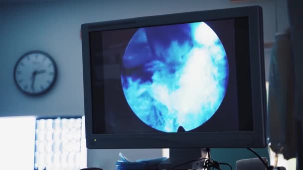Σάρωση Υπερήχων Ακτίνες Σύγχρονη Τεχνολογία Για Διάγνωση Της Ανθρώπινης Νόσου — Αρχείο Βίντεο