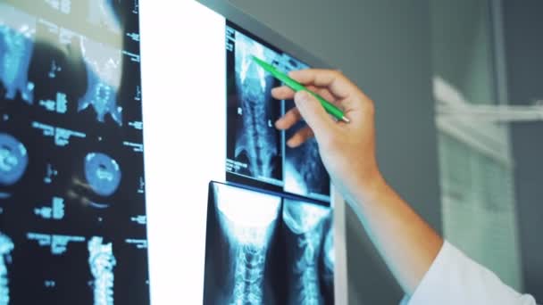 Cerrah Hastanın Röntgenine Bakıyor Kamu Sağlık Ocağında Çalışan Erkek Doktor — Stok video