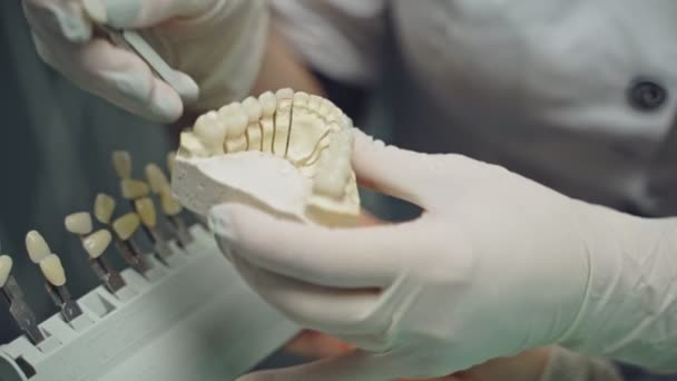 Vrouwelijke Handen Witte Handschoenen Kiezen Juiste Kleur Van Een Tand — Stockvideo