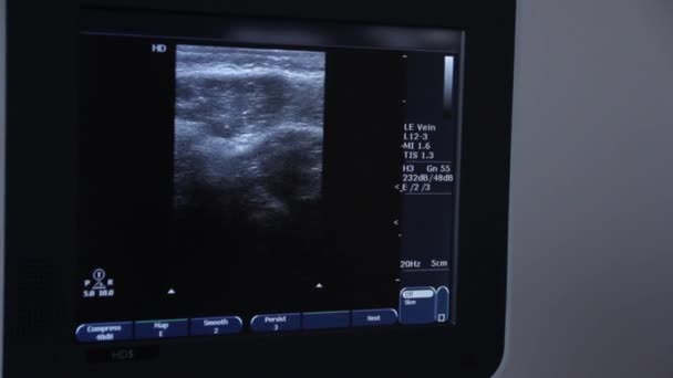 特写镜头和超声波机 显示超声波系统上的人体器官图像 现代诊所 — 图库视频影像