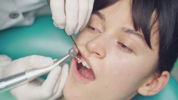 Bir Dişçi Diş Sağlığı Merkezindeki Müşterinin Dişlerindeki Depozitoları Beyazlatma Işini — Stok video