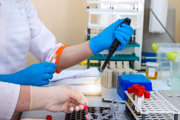 Hands Laboratory Assistant Gloves Analyzing Blood Sample Prevention Pneumonia Diagnosing — Stock Photo, Image
