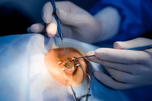 Especialista Médico Que Realiza Cirugía Oftalmológica Equipamiento Moderno Corrección Visión — Foto de Stock