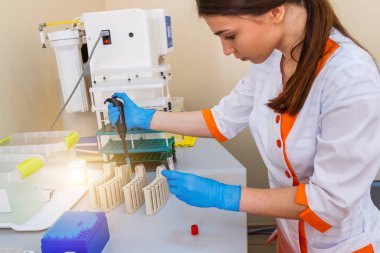 Laboratuvarda test ediliyor. Kimyasal araştırma. Önlem olarak. Zatürree teşhisi. COVID-19 ve koronavirüs teşhisi. Salgın. Kanlı ilaç damlası..