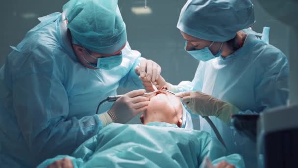 Tandläkare Operation För Implantat Placering Begreppet Tandvårdsklinik — Stockvideo