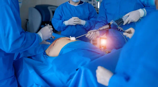 医用机器人 医疗手术涉及机器人 机器人手术 — 图库照片