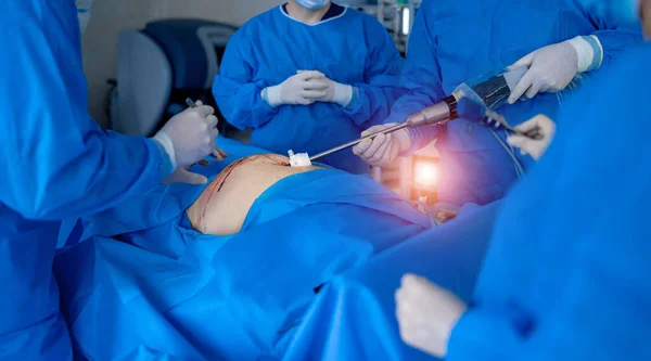 Lékařská Robota Operace Zahrnující Robot Robotické Chirurgie — Stock fotografie