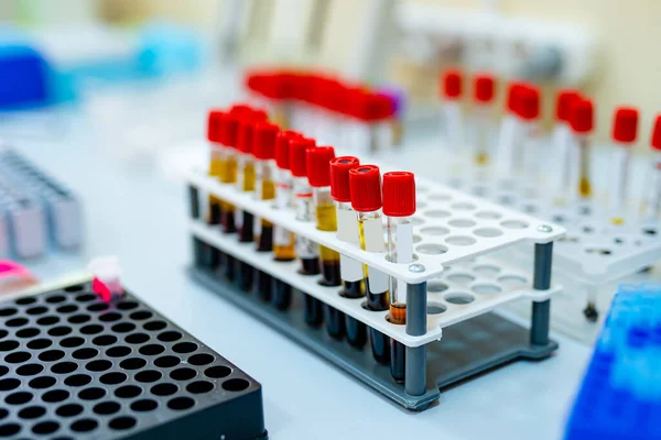Campioni Sangue Ricerca Nei Microtubi Test Laboratorio Ricerca Chimica Prevenzione — Foto Stock