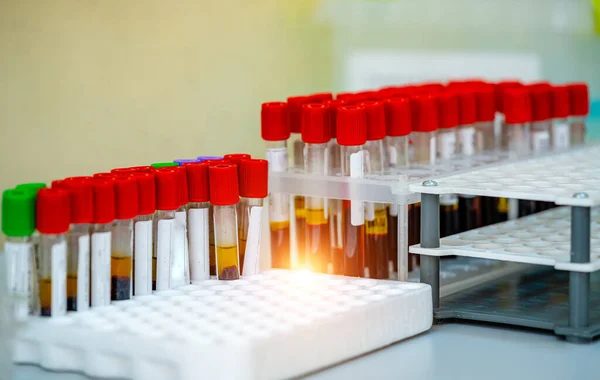 Rack Blood Tubes Test Analysis Laboratory Hematology Blood Laboratory Illness — Stock Photo, Image
