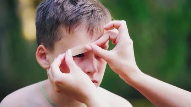 Trauriger Junge Mit Verletzung Der Augenbraue Frauenhände Legen Freien Kleine — Stockvideo