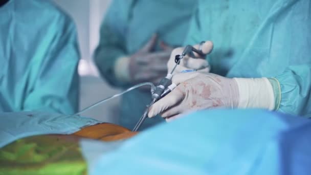 Special Instrument Operation Surgeon Hands Operating Process Surgery Room Close — Stok video